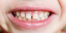 smile