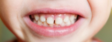 smile