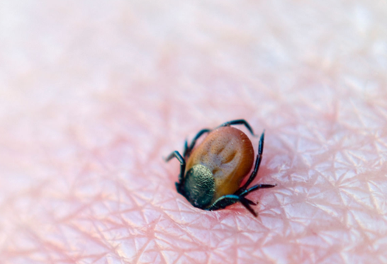 close-up of tick burrowed in skin