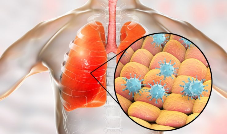 Coronavirus in lung