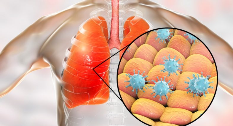 Coronavirus in lung
