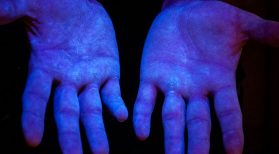 palms of 2 hands shown under ultraviolet light